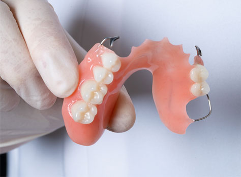partial dentures in san diego
