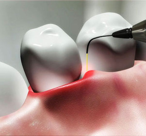 Specialty Periodontal Services In Mira Mesa
