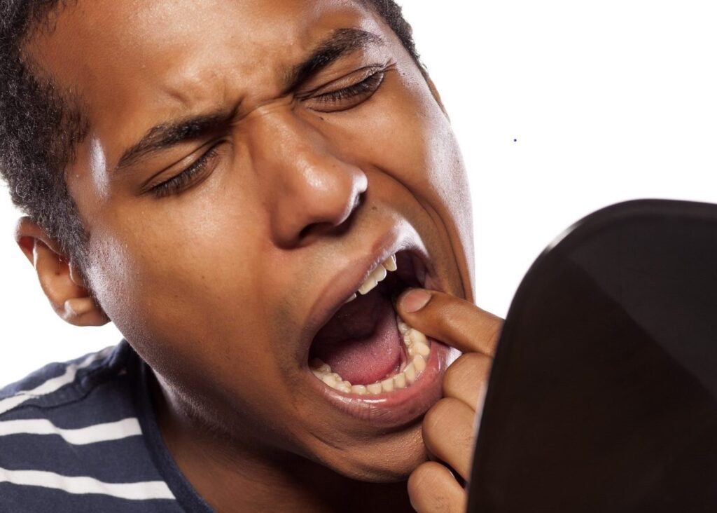 loosening of permanent adult teeth