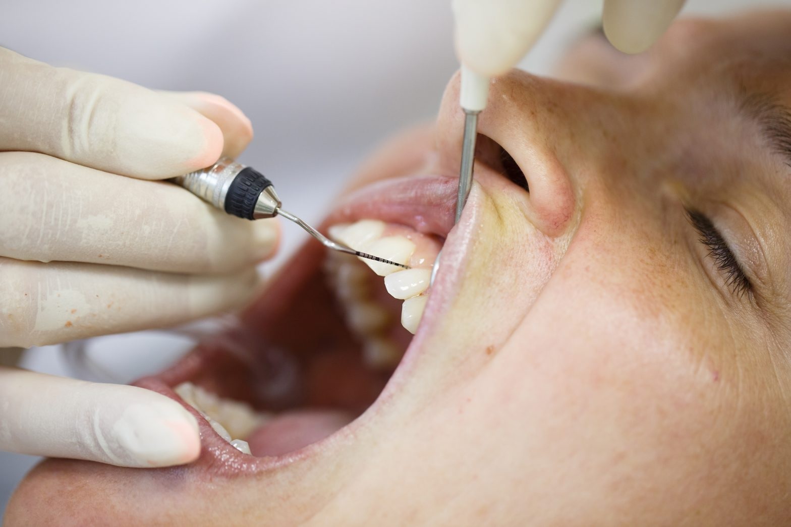 what is periodontal disease and treatment options