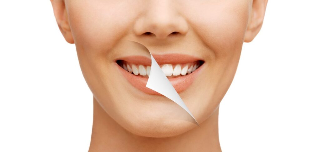 differences between in office and at home whitening treatments